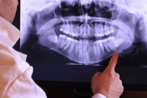 Best Emergency Dental Filling Replacement  in Cumberland Hill, RI