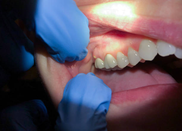 Best Urgent Dental Care  in Cumberland Hill, RI