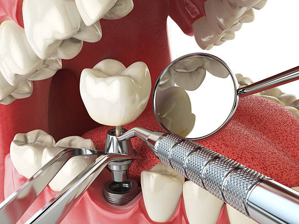 Best Cracked Tooth Emergency Dentist  in Cumberland Hill, RI