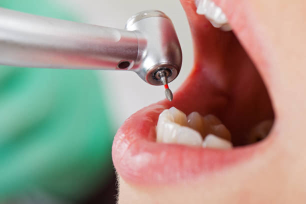 Best Urgent Tooth Repair  in Cumberland Hill, RI